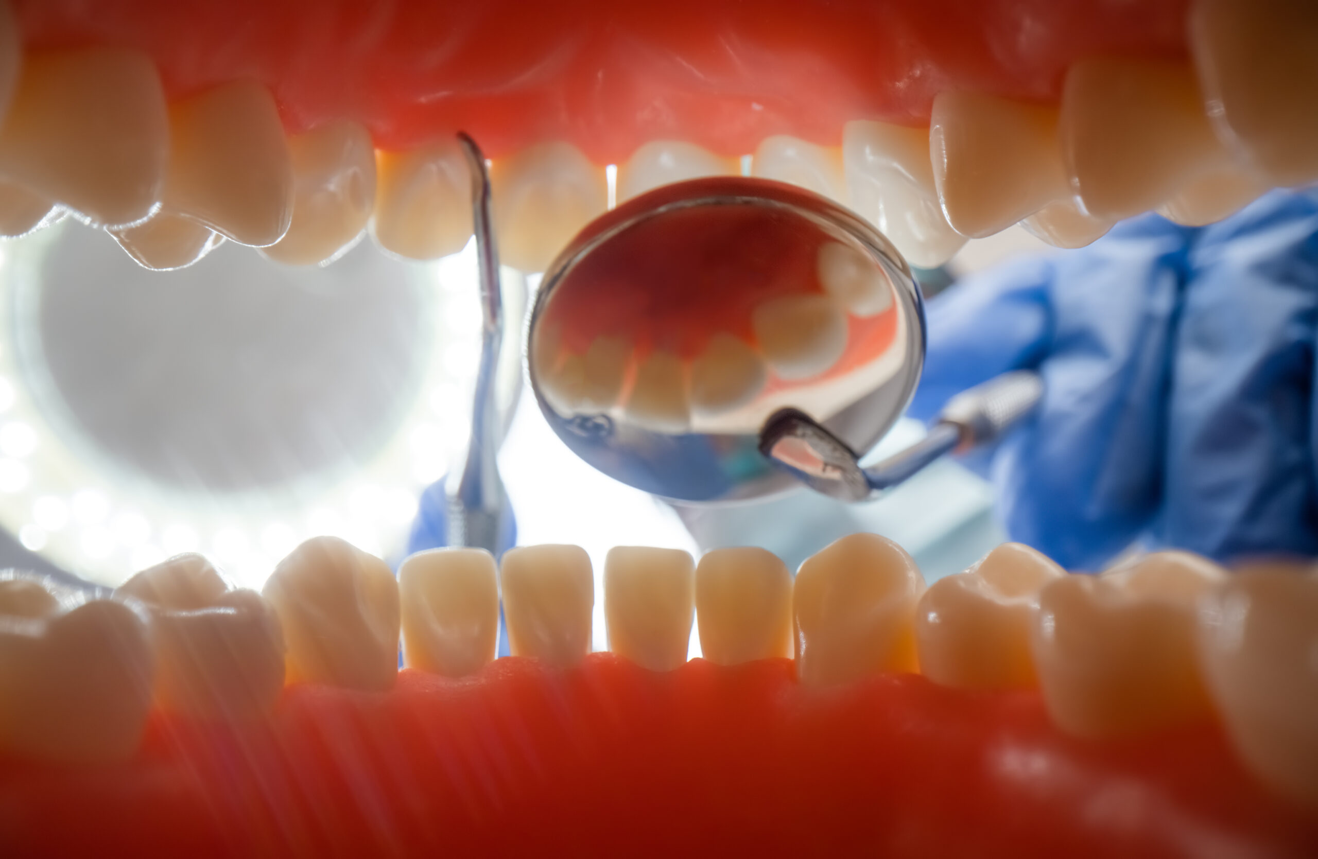 Vista desde el interior de la boca durante una revisión dental en clínica dental en Vigo