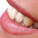Primer plano de una sonrisa con dientes blancos y encías saludables