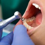 Odontopediatría en Vigo