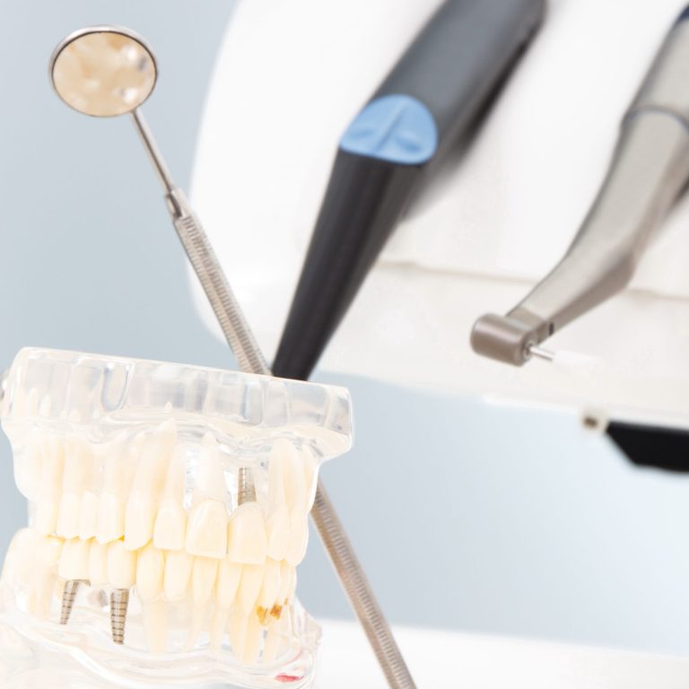Modelo dental con implantes y herramientas odontológicas en clínica dental en Vigo