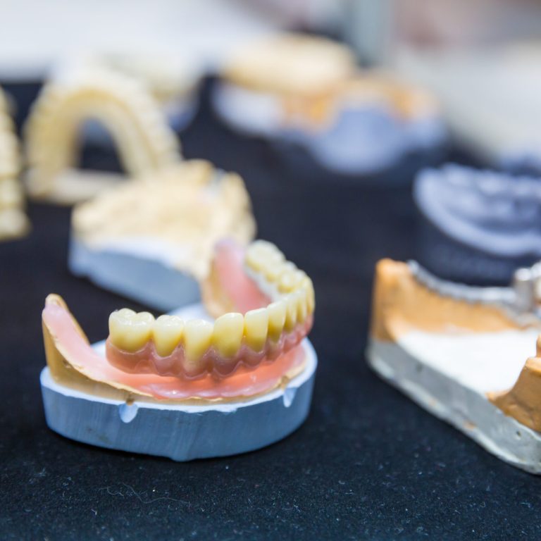 Denture treatment, dental implants closeup, medicine equipment. Dentist cabinet, stomatology. Tooth care mouth hygiene