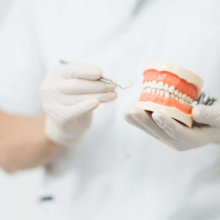 En Salvador Rico Odontología Integral, clínica dental en Vigo, utilizamos modelos dentales para explicar a nuestros pacientes cómo prevenir y tratar problemas como el bruxismo, la retracción de encías o las enfermedades periodontales. La educación es clave para mantener una sonrisa saludable a largo plazo.