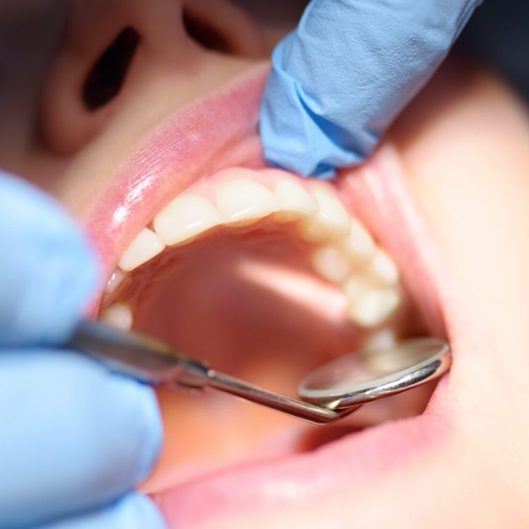 Paciente con molestias en un diente durante revisión en clínica dental de Vigo.