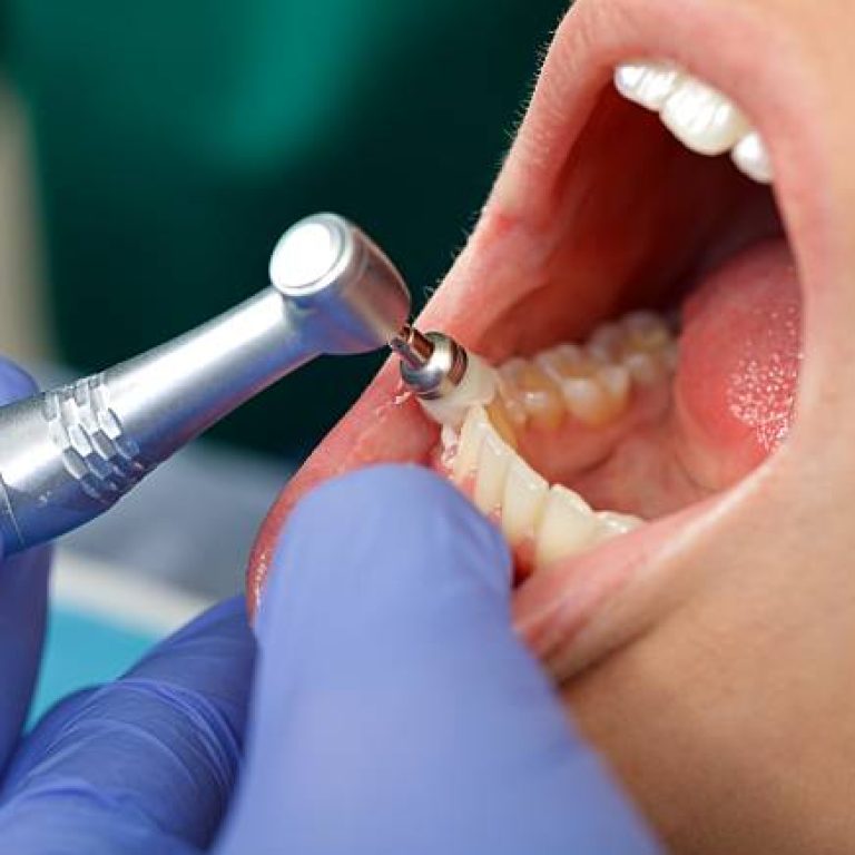 Odontopediatría en Vigo