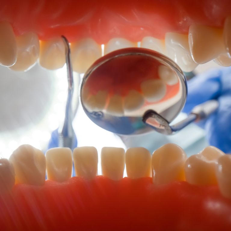 Vista desde el interior de la boca durante una revisión dental en clínica dental en Vigo