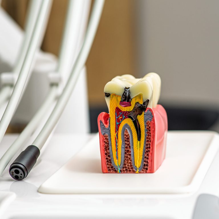 Stomatology concept. Detailed tooth model showcases the layers of enamel and dentin in a bright dental office equipped for patient care