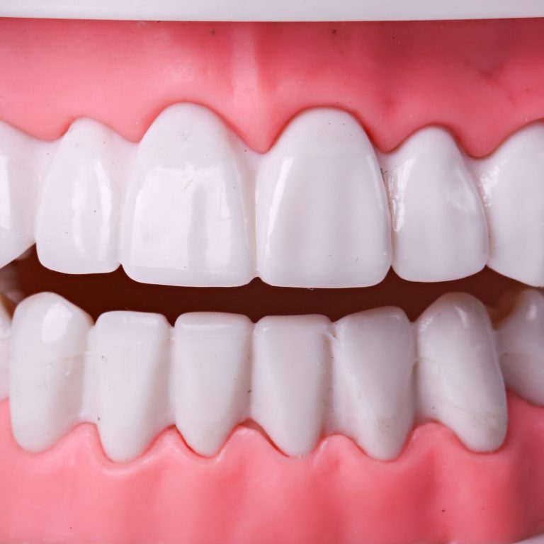 White teeth on the table