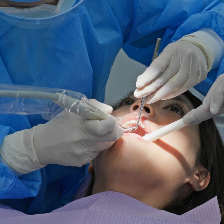 blanqueamiento dental en Vigo
